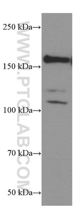 TrkC Antibody in Western Blot (WB)