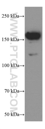 TrkC Antibody in Western Blot (WB)