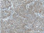 SLCO1B3 Antibody in Immunohistochemistry (Paraffin) (IHC (P))