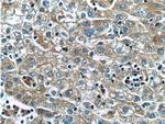 SLCO1B3 Antibody in Immunohistochemistry (Paraffin) (IHC (P))