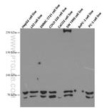 SLCO1B3 Antibody in Western Blot (WB)