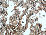 OGN Antibody in Immunohistochemistry (Paraffin) (IHC (P))