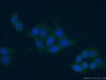 NAMPT/PBEF Antibody in Immunocytochemistry (ICC/IF)