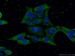 GSDMD Antibody in Immunocytochemistry (ICC/IF)