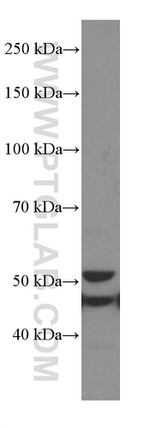 GSDMD Antibody in Western Blot (WB)