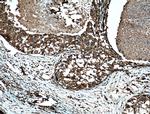 FKBPL Antibody in Immunohistochemistry (Paraffin) (IHC (P))