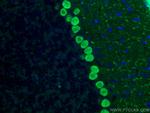 Calbindin-D28k Antibody in Immunohistochemistry (PFA fixed) (IHC (PFA))