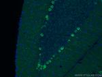 Calbindin-D28k Antibody in Immunohistochemistry (PFA fixed) (IHC (PFA))