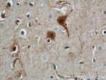 Calbindin-D28k Antibody in Immunohistochemistry (Paraffin) (IHC (P))