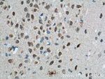 Calbindin-D28k Antibody in Immunohistochemistry (Paraffin) (IHC (P))