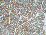 CD36 Antibody in Immunohistochemistry (Paraffin) (IHC (P))