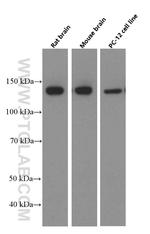 NF-M Antibody in Western Blot (WB)