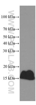 PLA2G1B Antibody in Western Blot (WB)