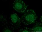 GATA3 Antibody in Immunocytochemistry (ICC/IF)