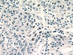 GATA3 Antibody in Immunohistochemistry (Paraffin) (IHC (P))