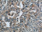 CALCOCO2 Antibody in Immunohistochemistry (Paraffin) (IHC (P))