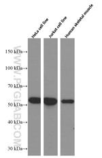 CALCOCO2 Antibody in Western Blot (WB)