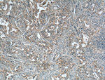 CALCOCO2 Antibody in Immunohistochemistry (Paraffin) (IHC (P))