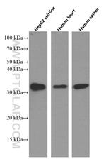 Annexin A3 Antibody in Western Blot (WB)