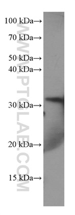 Annexin A3 Antibody in Western Blot (WB)