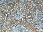 SIRT2 Antibody in Immunohistochemistry (Paraffin) (IHC (P))