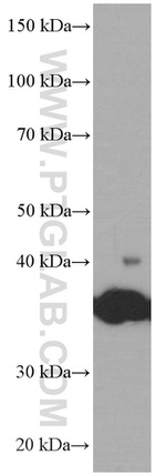 SIRT2 Antibody in Western Blot (WB)