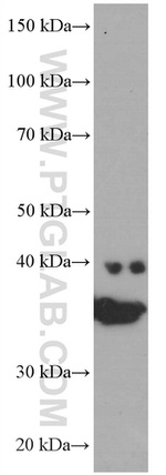 SIRT2 Antibody in Western Blot (WB)