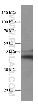 SIRT2 Antibody in Western Blot (WB)