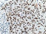 SOX2 Antibody in Immunohistochemistry (Paraffin) (IHC (P))