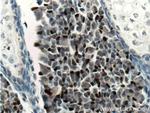 SOX2 Antibody in Immunohistochemistry (Paraffin) (IHC (P))