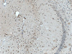 SOX2 Antibody in Immunohistochemistry (Paraffin) (IHC (P))