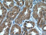 ZC3HAV1 Antibody in Immunohistochemistry (Paraffin) (IHC (P))