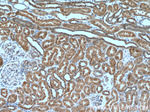 ZC3HAV1 Antibody in Immunohistochemistry (Paraffin) (IHC (P))