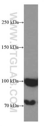 ZC3HAV1 Antibody in Western Blot (WB)