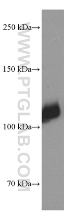 LDLR Antibody in Western Blot (WB)