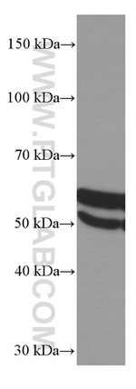 LAP3 Antibody in Western Blot (WB)