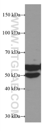 LAP3 Antibody in Western Blot (WB)