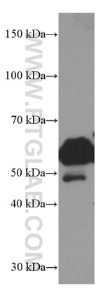 LAP3 Antibody in Western Blot (WB)