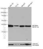 IkB alpha Antibody in Western Blot (WB)