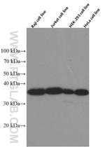 IkB alpha Antibody in Western Blot (WB)