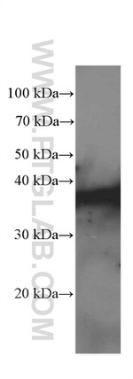 IkB alpha Antibody in Western Blot (WB)