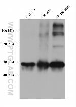 Calsequestrin 2 Antibody in Western Blot (WB)