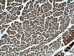 Calsequestrin 2 Antibody in Immunohistochemistry (Paraffin) (IHC (P))