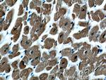 Calsequestrin 2 Antibody in Immunohistochemistry (Paraffin) (IHC (P))