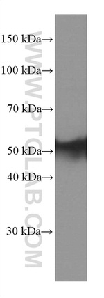 Calsequestrin 2 Antibody in Western Blot (WB)