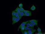 PKC alpha Antibody in Immunocytochemistry (ICC/IF)