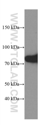 PKC alpha Antibody in Western Blot (WB)