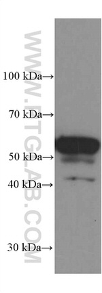 PDI Antibody in Western Blot (WB)