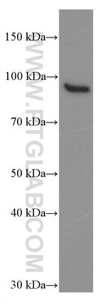 STAT5B Antibody in Western Blot (WB)