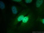 STAT5B Antibody in Immunocytochemistry (ICC/IF)